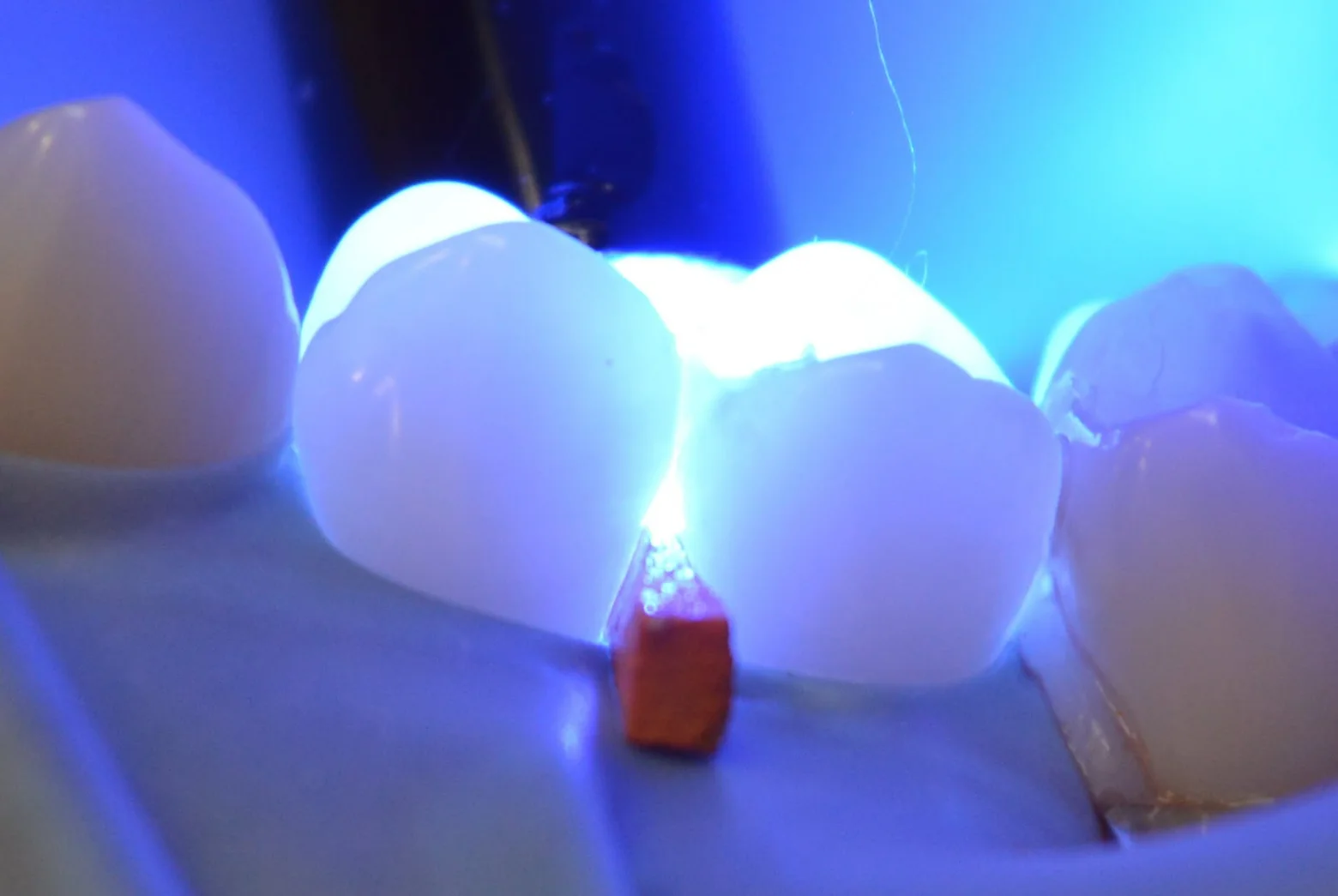 Ceramic restorations under the blue curing light, in Dr. Sremčević’s practice