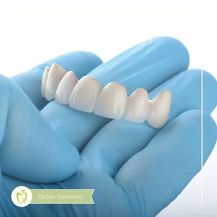 A new restoration held in a gloved hand at Dr. Sremčević’s practice