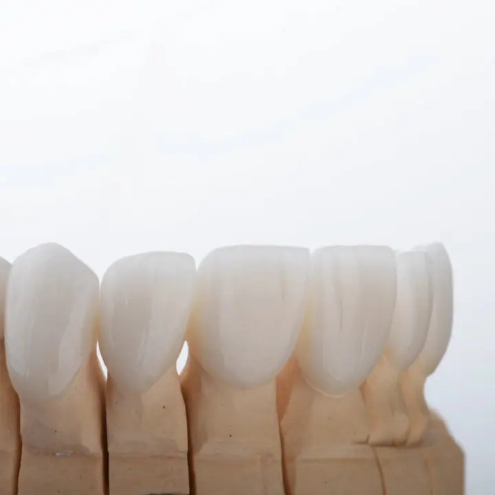 New restorations on a working model at Dr. Sremčević’s practice