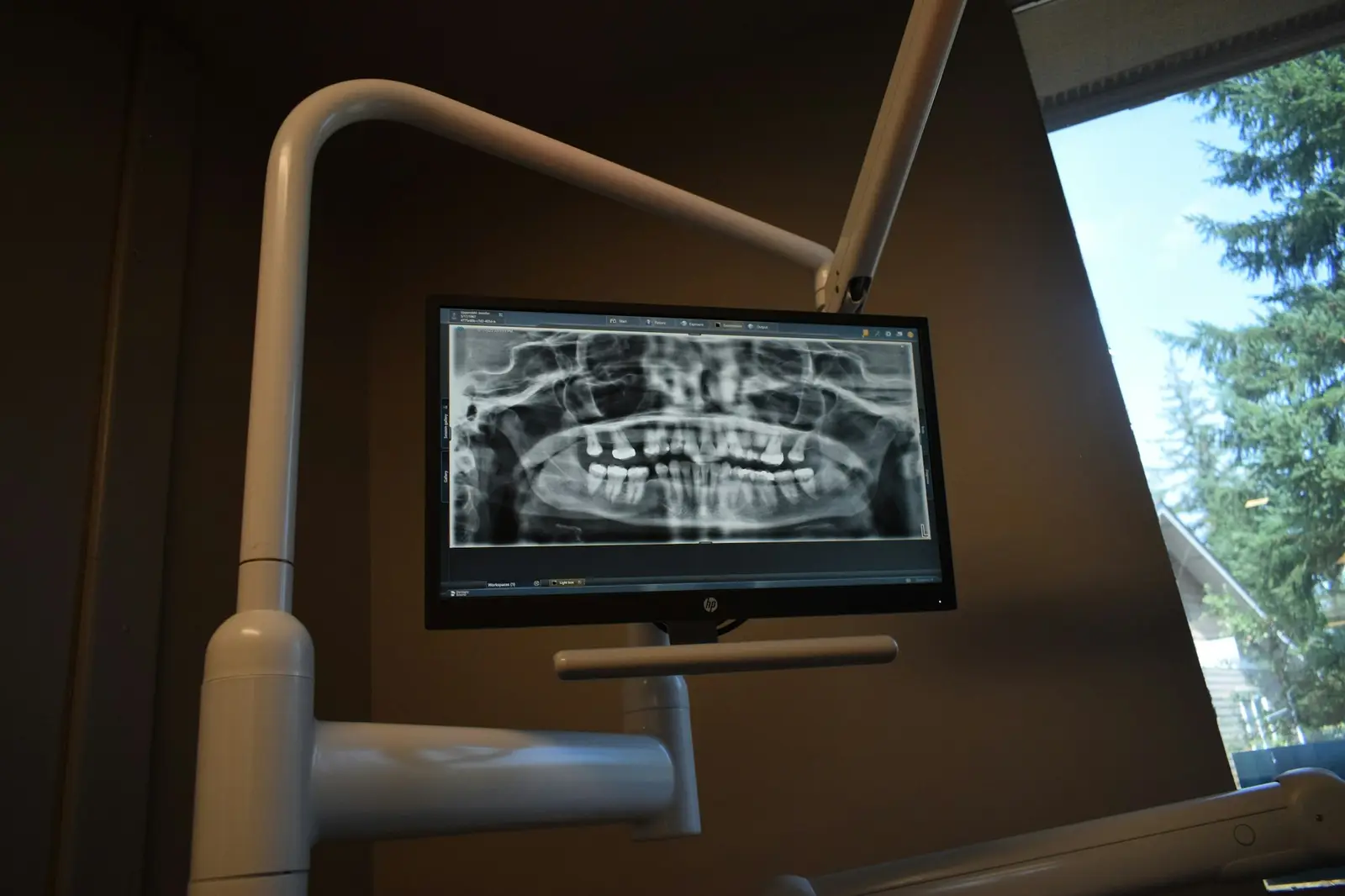 Dental X-ray on a clinic monitor