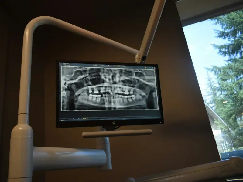 A dental X-ray on a clinic monitor